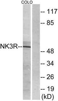 NK-3R rabbit pAb Antibody