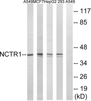 NKp46 rabbit pAb Antibody