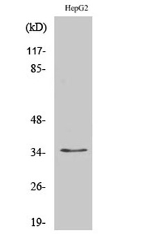 Nkx-3.1 rabbit pAb Antibody