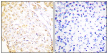 Nkx-3.1 rabbit pAb Antibody