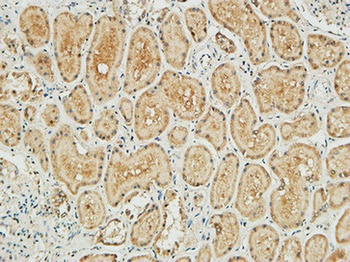 NM23-H1 rabbit pAb Antibody