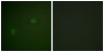 NPM rabbit pAb Antibody