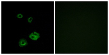 NPY2-R rabbit pAb Antibody
