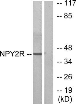 NPY2-R rabbit pAb Antibody