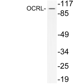 OCRL rabbit pAb Antibody