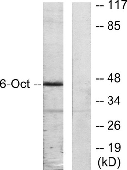 Oct-6 rabbit pAb Antibody
