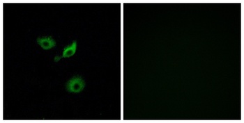 Olfactory receptor 10AD1 rabbit pAb Antibody