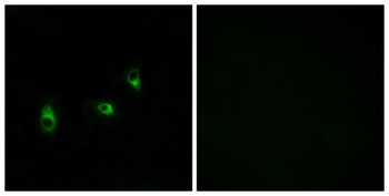 Olfactory receptor 10G2 rabbit pAb Antibody