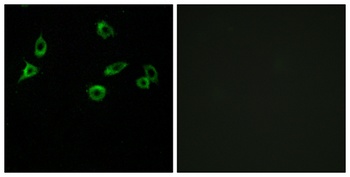 Olfactory receptor 10S1 rabbit pAb Antibody