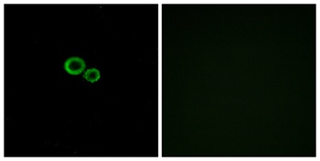 Olfactory receptor 11G2 rabbit pAb Antibody