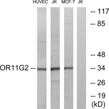 Olfactory receptor 11G2 rabbit pAb Antibody