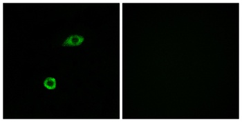 Olfactory receptor 1B1 rabbit pAb Antibody