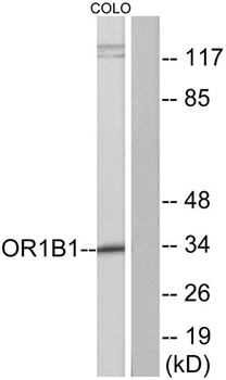 Olfactory receptor 1B1 rabbit pAb Antibody