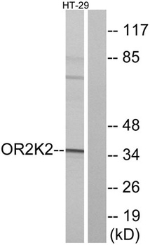 Olfactory receptor 2K2 rabbit pAb Antibody