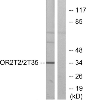 Olfactory receptor 2T2/35 rabbit pAb Antibody
