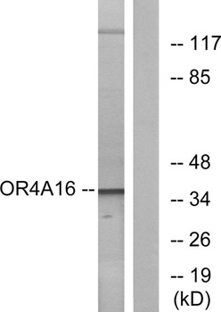 Olfactory receptor 4A16 rabbit pAb Antibody