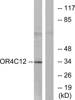 Olfactory receptor 4C12 rabbit pAb Antibody
