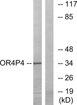 Olfactory receptor 4P4 rabbit pAb Antibody
