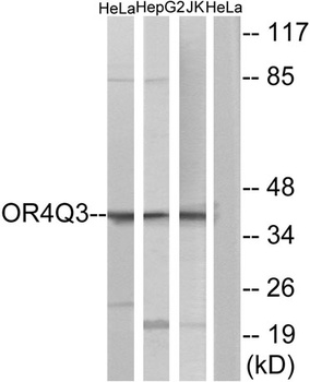 Olfactory receptor 4Q3 rabbit pAb Antibody