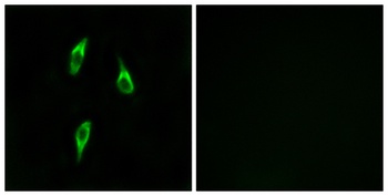 Olfactory receptor 51B2 rabbit pAb Antibody