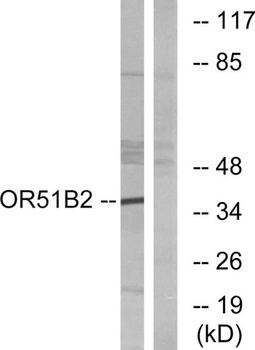 Olfactory receptor 51B2 rabbit pAb Antibody