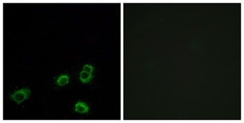 Olfactory receptor 52A1 rabbit pAb Antibody