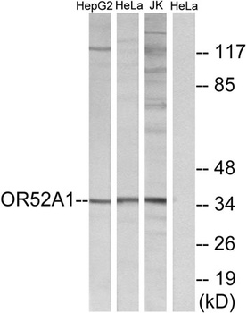 Olfactory receptor 52A1 rabbit pAb Antibody