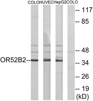Olfactory receptor 52B2 rabbit pAb Antibody