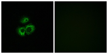 Olfactory receptor 52D1 rabbit pAb Antibody