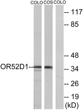 Olfactory receptor 52D1 rabbit pAb Antibody