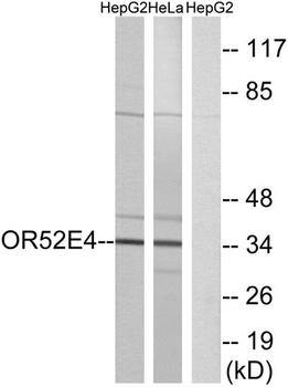 Olfactory receptor 52E4 rabbit pAb Antibody