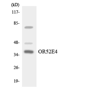 Olfactory receptor 52E4 rabbit pAb Antibody