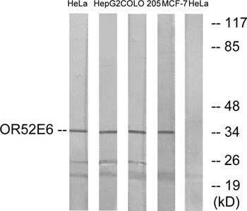 Olfactory receptor 52E6 rabbit pAb Antibody