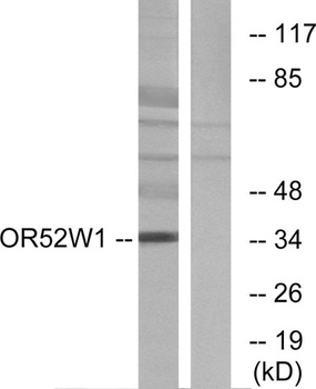 Olfactory receptor 52W1 rabbit pAb Antibody