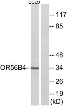 Olfactory receptor 56B4 rabbit pAb Antibody