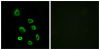 Olfactory receptor 5K1 rabbit pAb Antibody