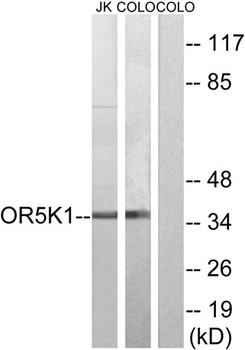 Olfactory receptor 5K1 rabbit pAb Antibody