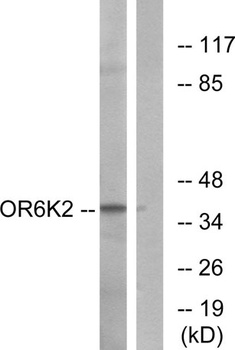 Olfactory receptor 6K2 rabbit pAb Antibody