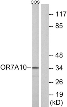 Olfactory receptor 7A10 rabbit pAb Antibody