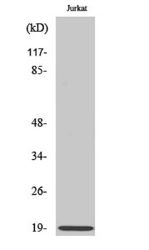 Op18 rabbit pAb Antibody