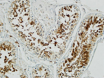Op18 rabbit pAb Antibody