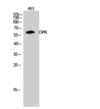 OPN rabbit pAb Antibody