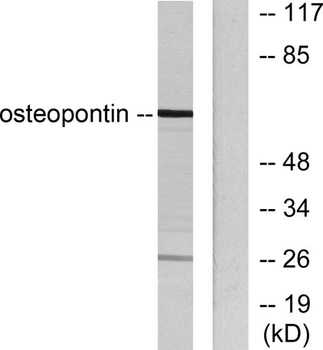 OPN rabbit pAb Antibody