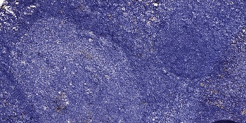 OPN rabbit pAb Antibody