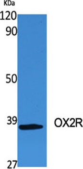 OX2R rabbit pAb Antibody