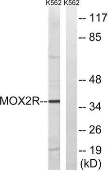 OX2R rabbit pAb Antibody