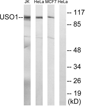 p115 rabbit pAb Antibody