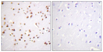 p120 rabbit pAb Antibody
