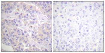p130 Cas rabbit pAb Antibody