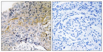 p130 Cas rabbit pAb Antibody